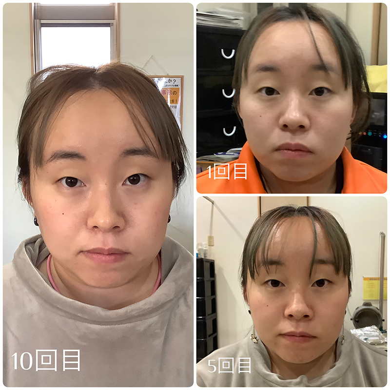 ビフォーアフター画像