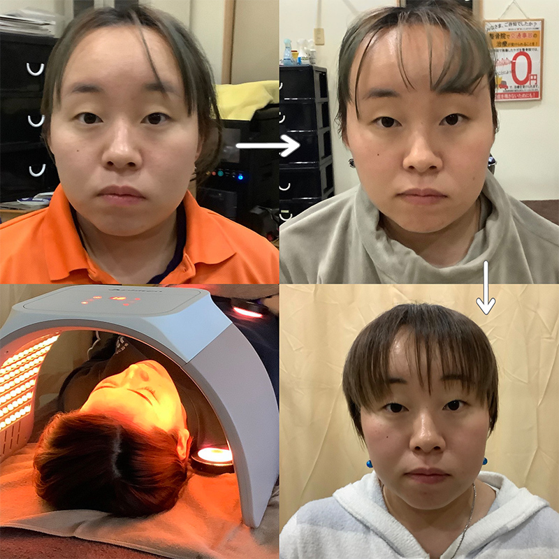 ビフォーアフター画像
