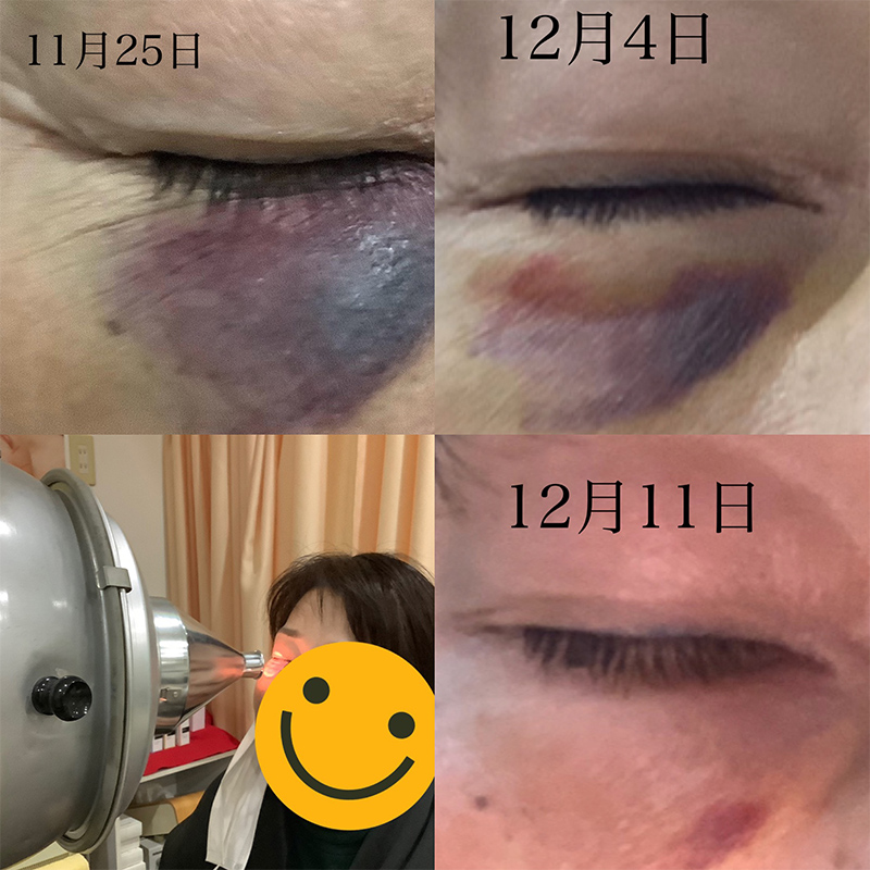 ビフォーアフター画像