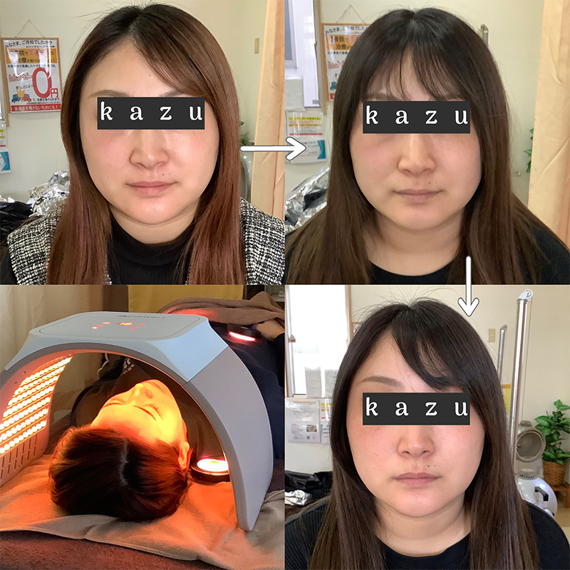 ビフォーアフター画像