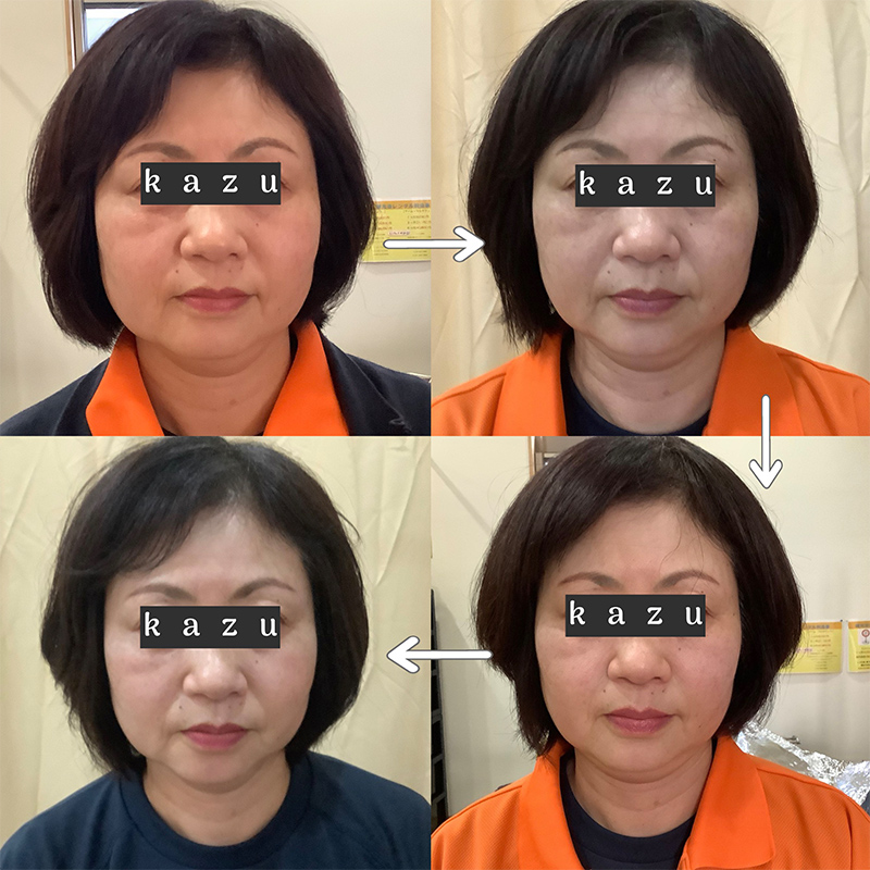 ビフォーアフター画像