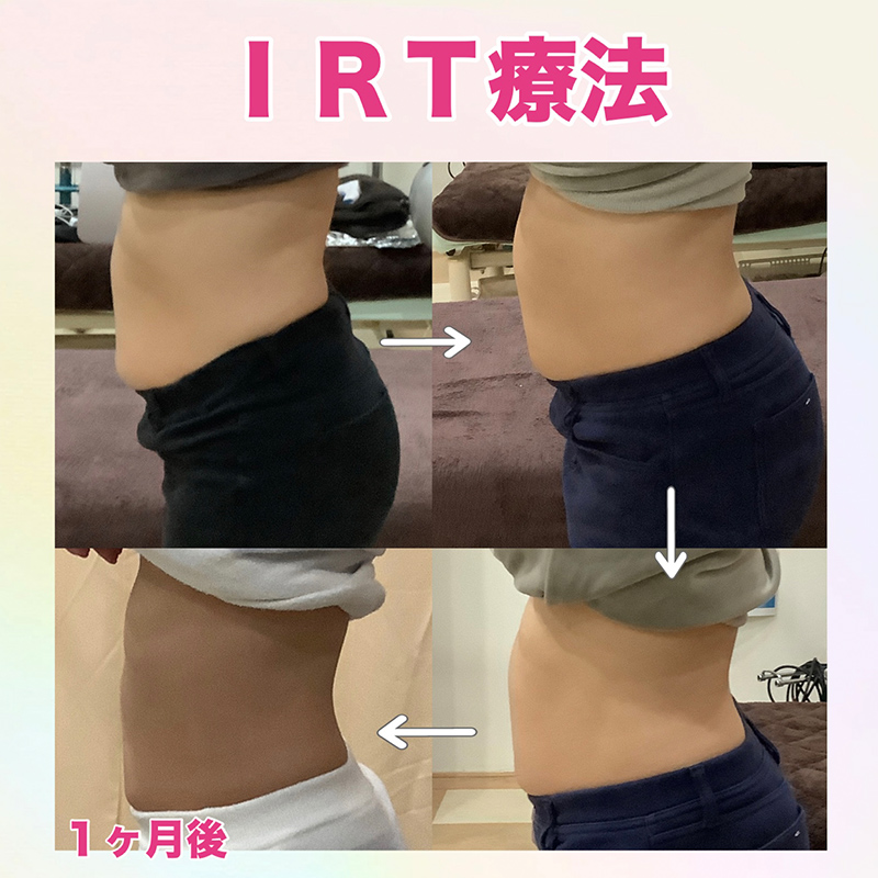 ビフォーアフター画像