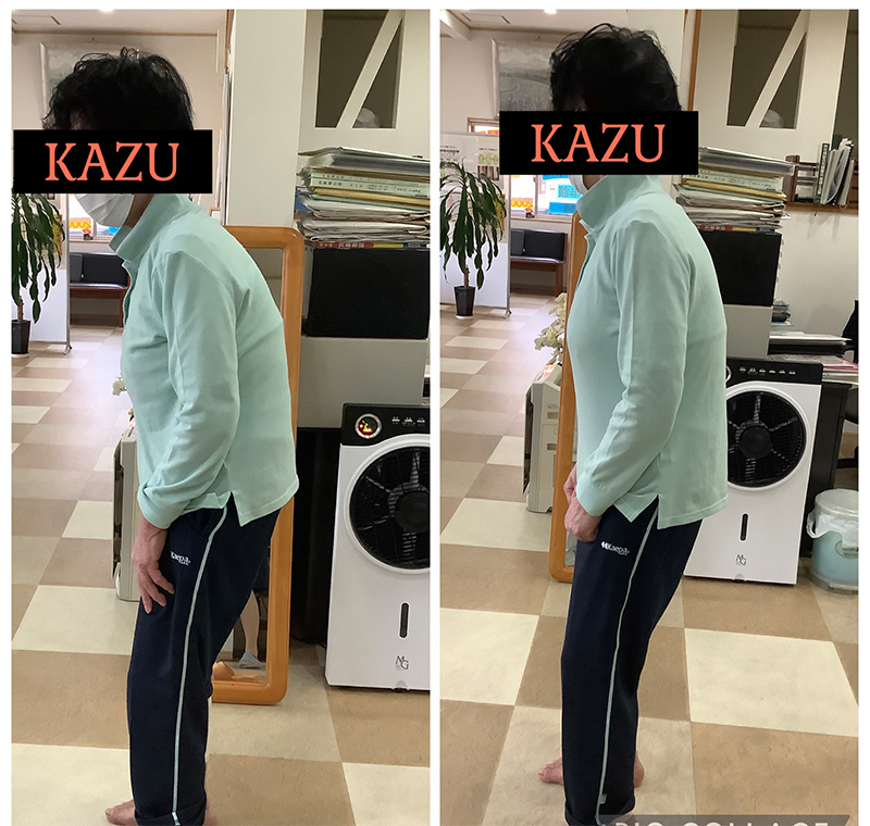 ビフォーアフター画像