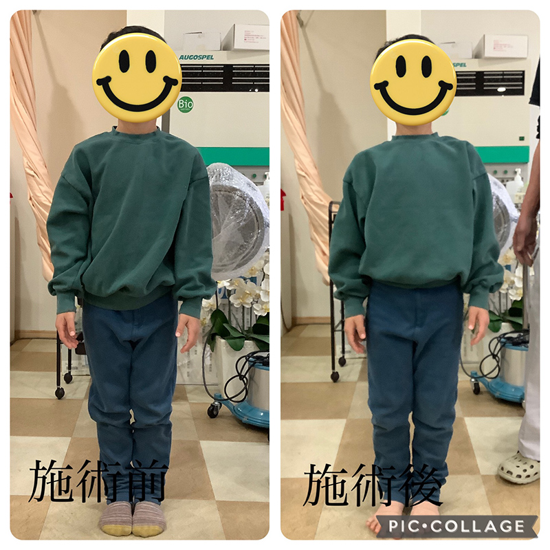 ビフォーアフター画像