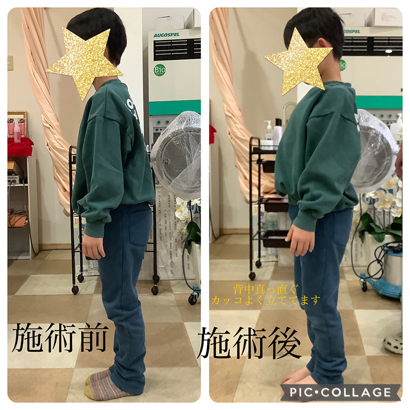 ビフォーアフター画像