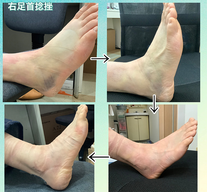ビフォーアフター画像