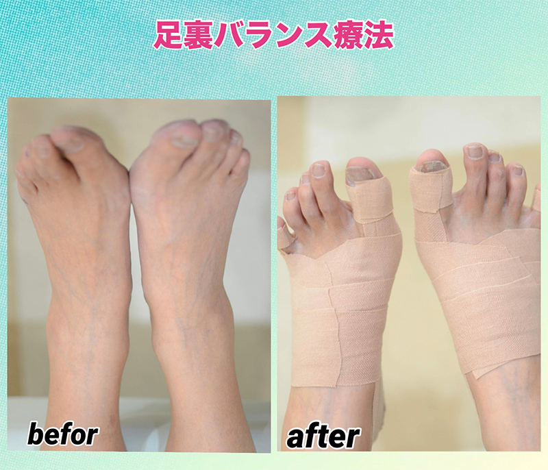 ビフォーアフター画像