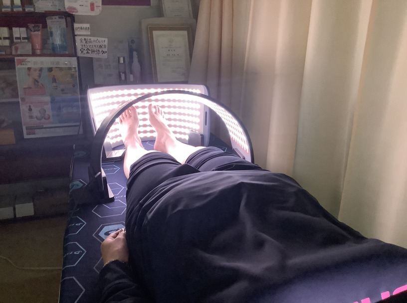 光線療法