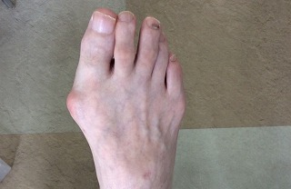 足裏バランス療法の写真